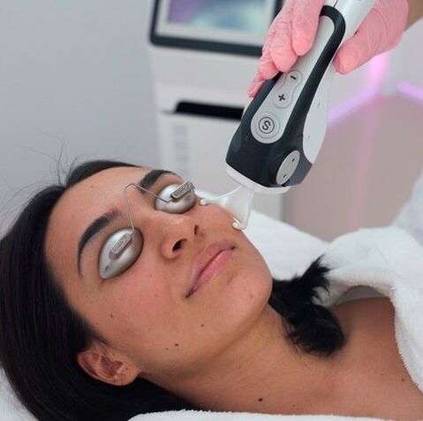 Upat ka mga pigment spots
