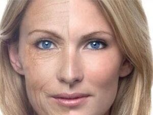 Pigmentation sa panit