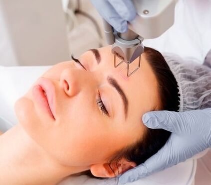 ang diwa sa fractional laser sa nawong panit rejuvenation pamaagi